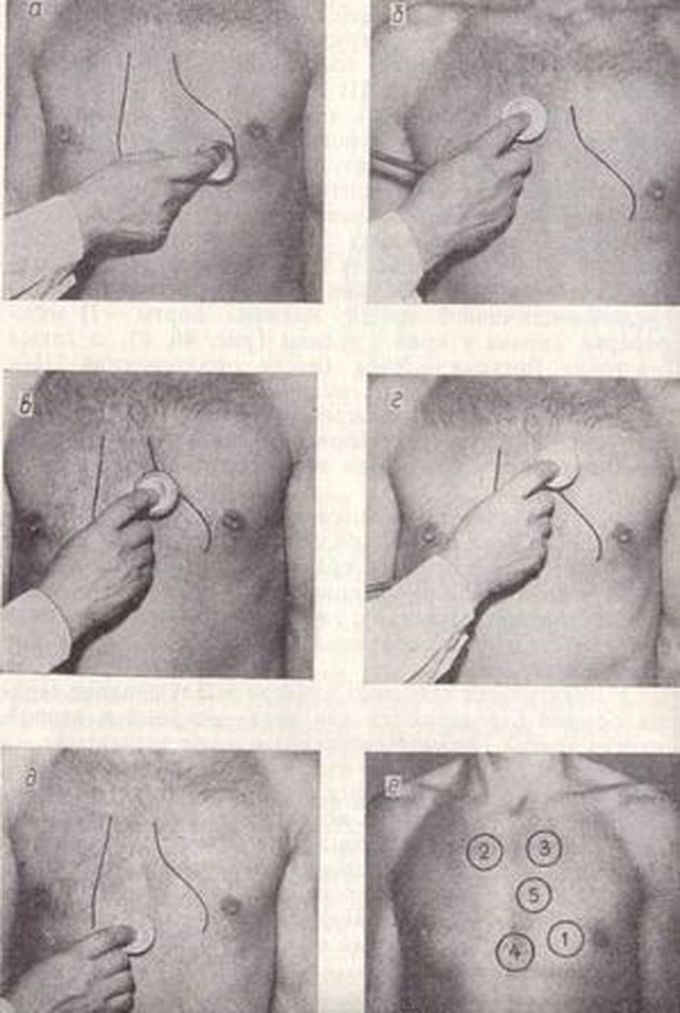 Проекция Сердечных клапанов #the projection of the Heart valves