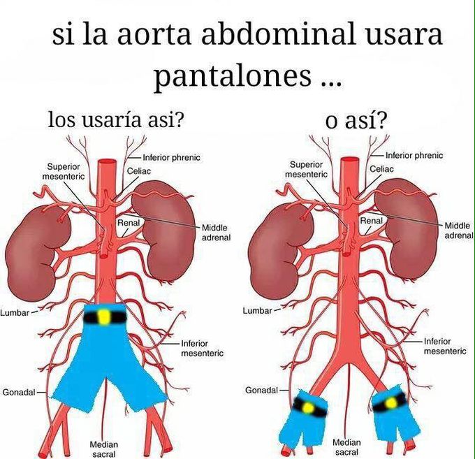 Aorta abdominal