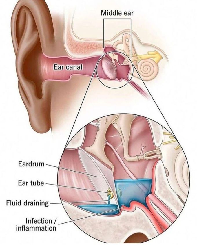 Middle Ear Anatomy