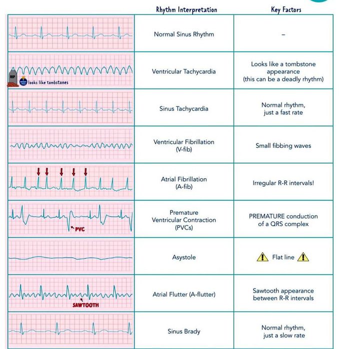 Rhythm Interpretation