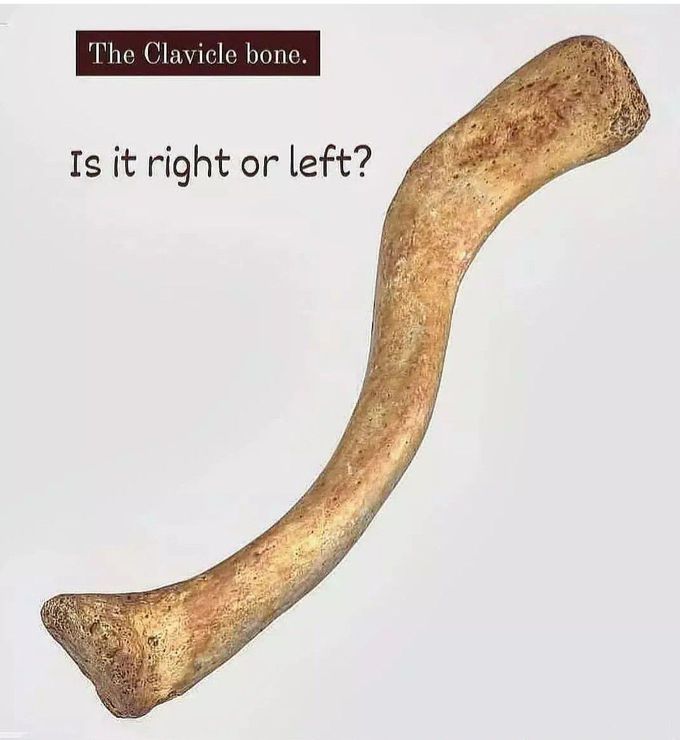 Identify the Bone