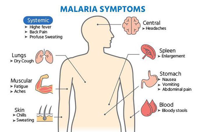 Symptoms of malaria