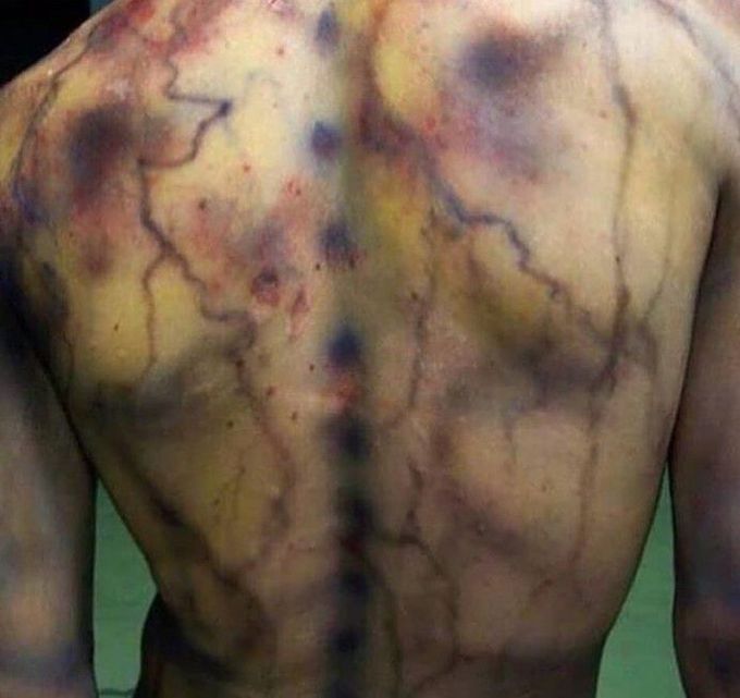 Lichtenberg Figures