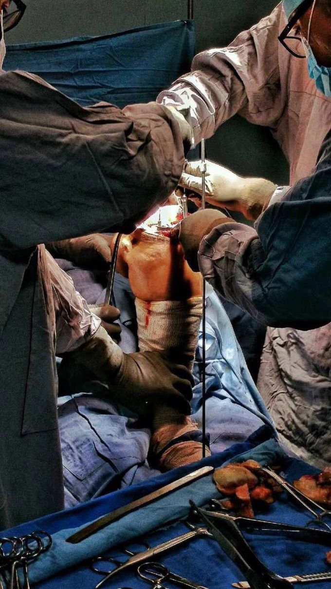 Surgery