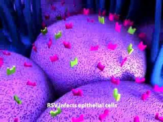 RSV disease (serious threat to children)