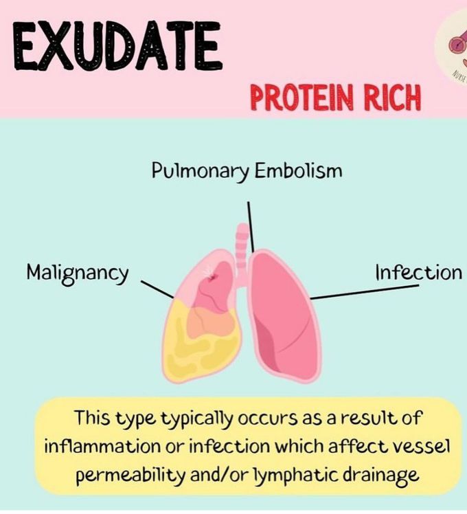 Exudate