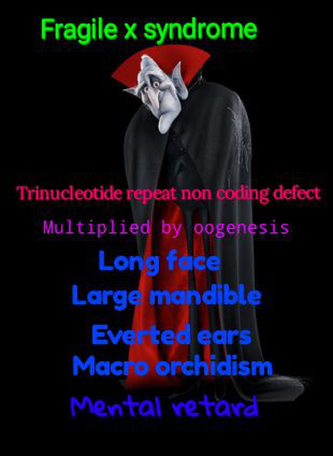 Fragile x syndrome
