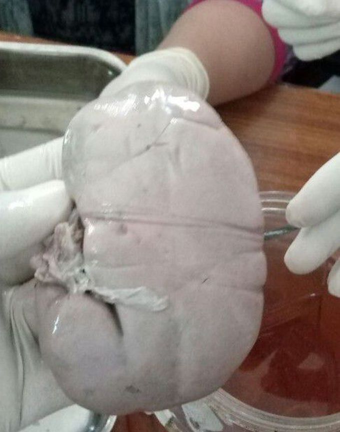 Anatomy
