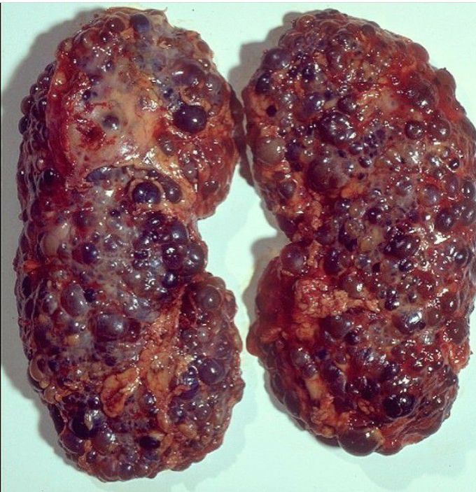 Diagnosis?
