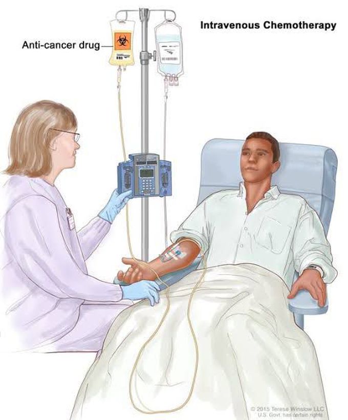 Chemotherapy