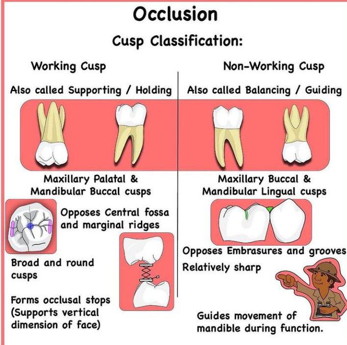 Occlusion - Cusp Classification