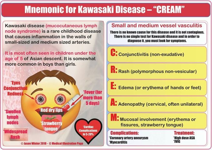 Kawasaki disease
