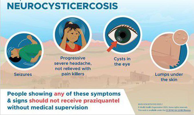 Symptoms of Neurocysticercosis