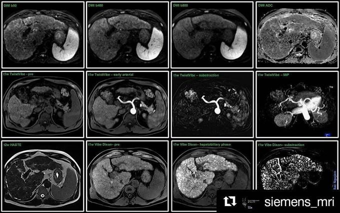 Abdominal Imaging w/Primovist