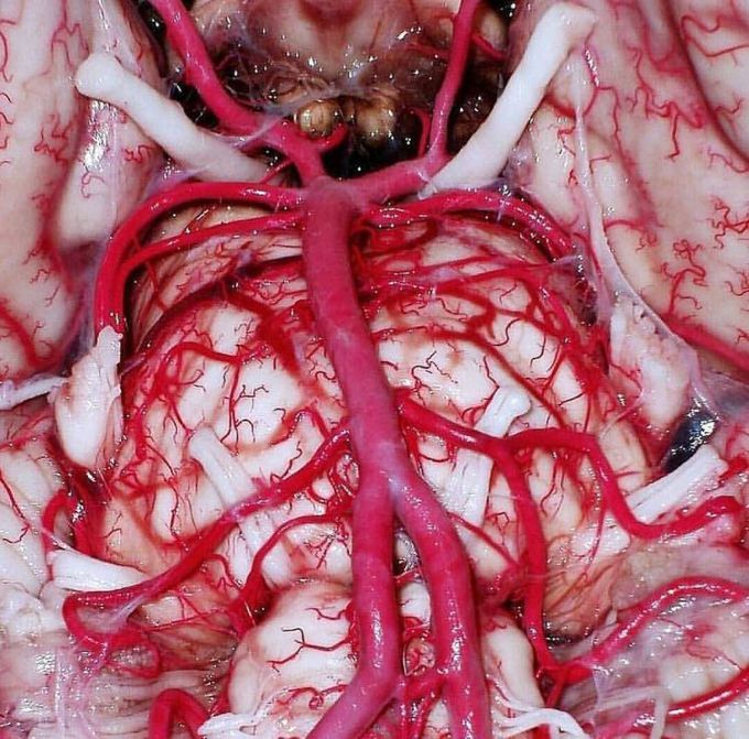 🔝Fantastic view of the Vertebrobasilar system