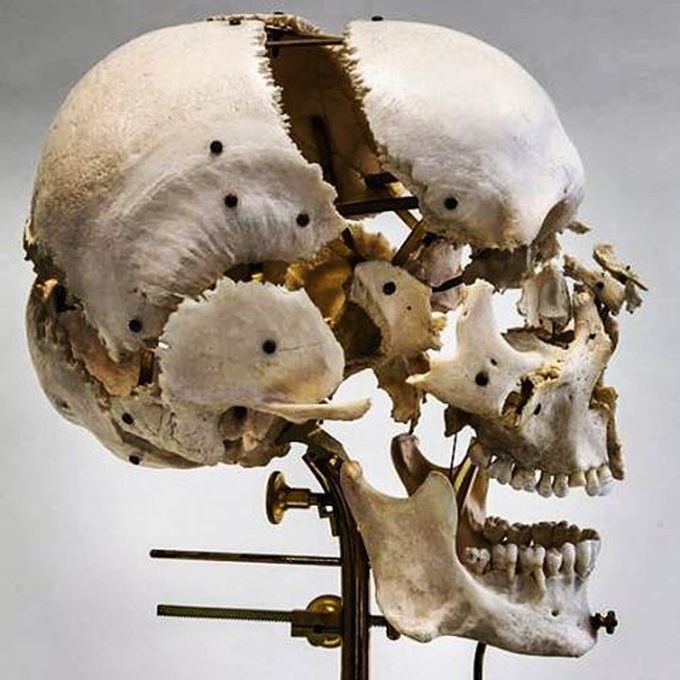 Antique and original Beauchene (exploded) skull circa 1870 on wooden/brass stand