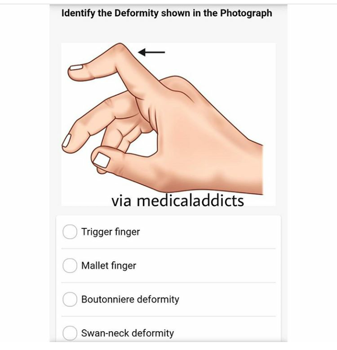 Identify
