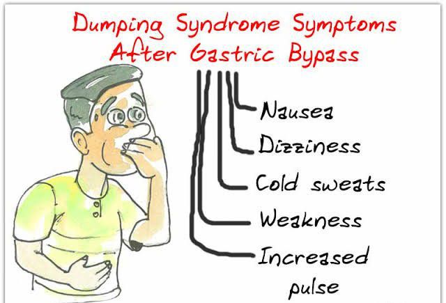 These Are The Symptoms Of Dumping Syndrome MEDizzy