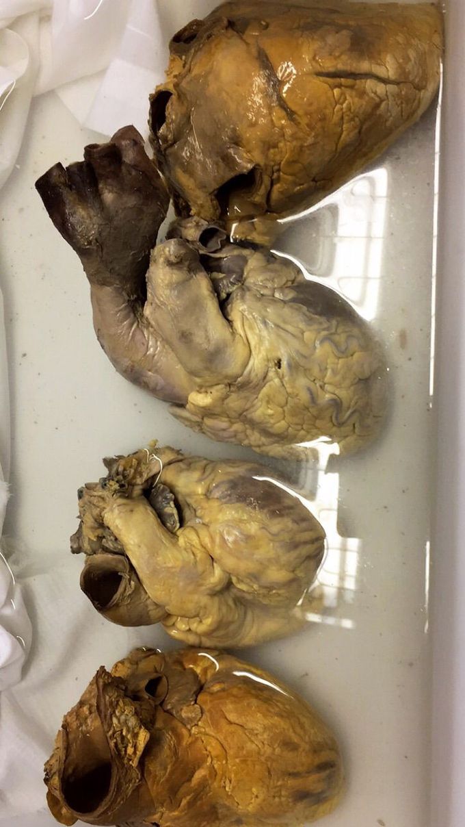 heart
