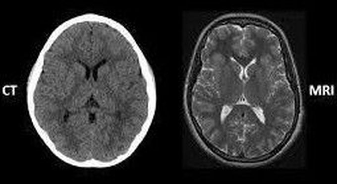 CT AND MRI