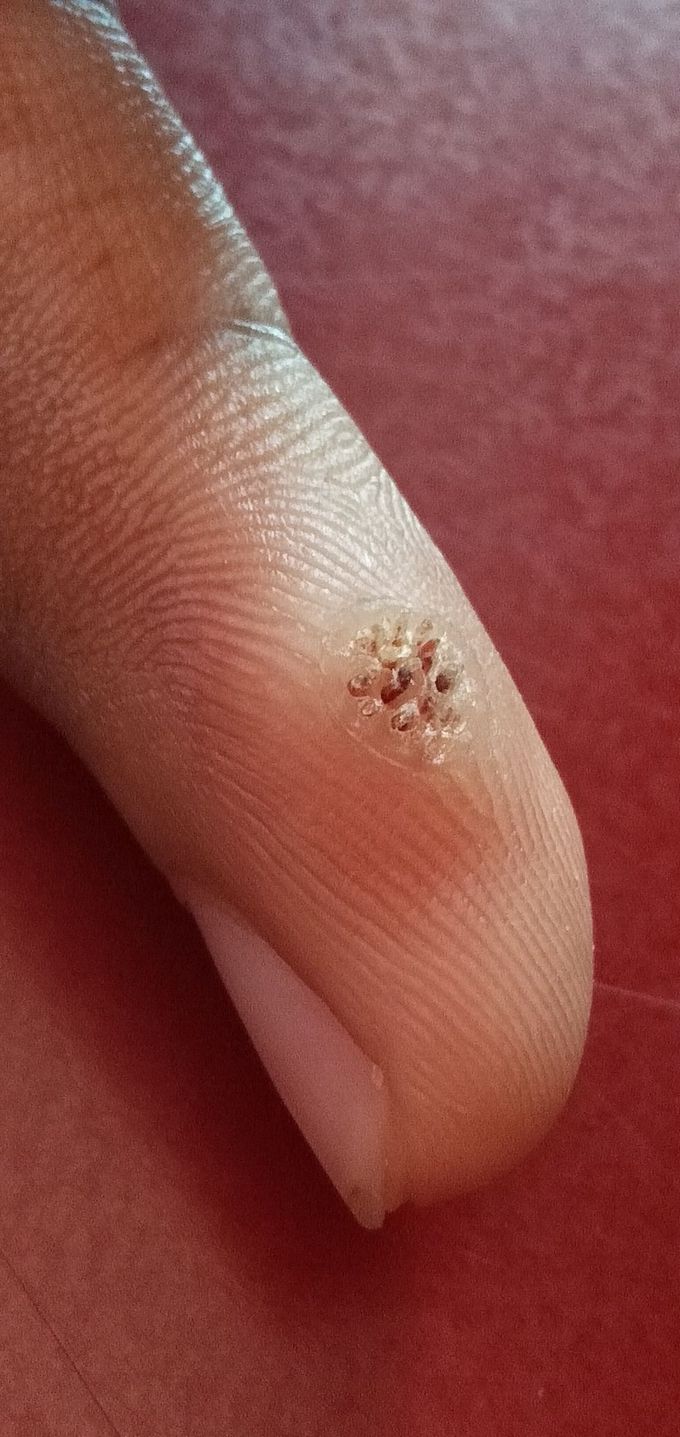 What do you diagnose..??