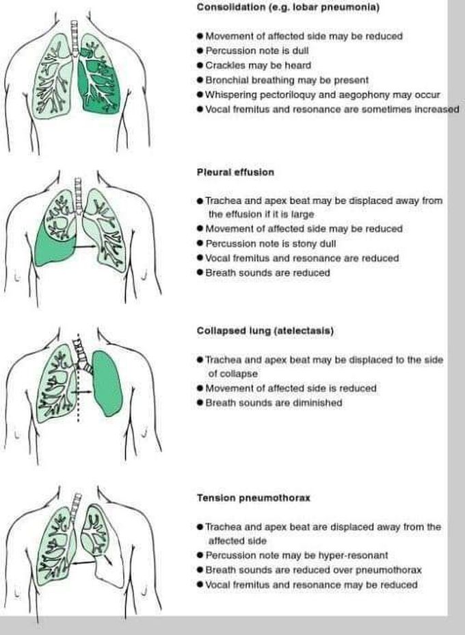 Physiology respiratory.