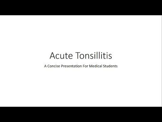 What is Acute Tonsilitis?