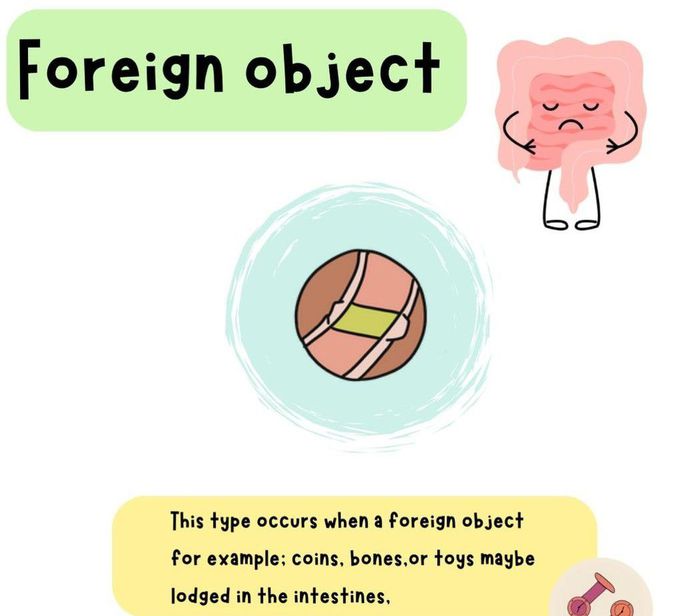 Foreign Object