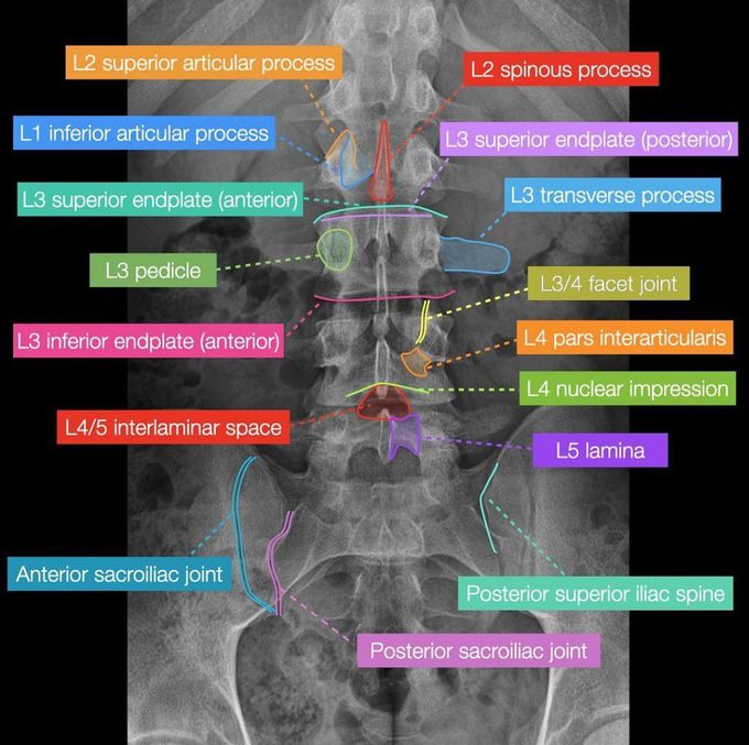 Spine Radiology I