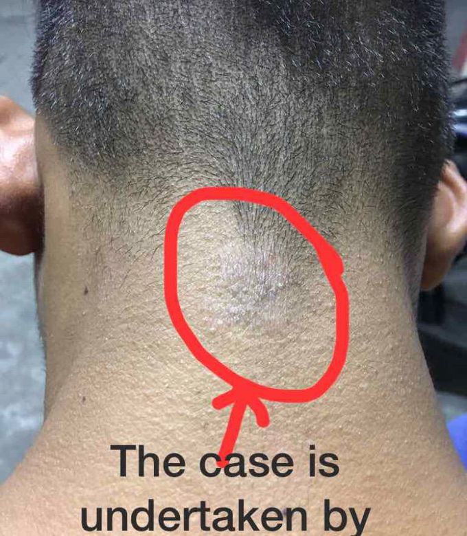 Dermatology case!!!