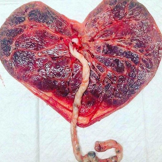The placenta