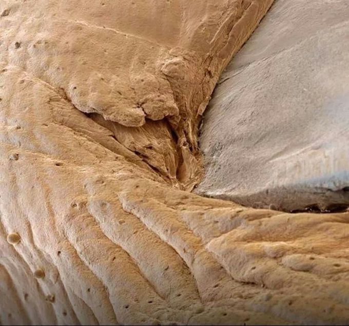 Human finger nail