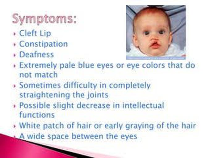 These are the symptoms of Waardenburg syndrome