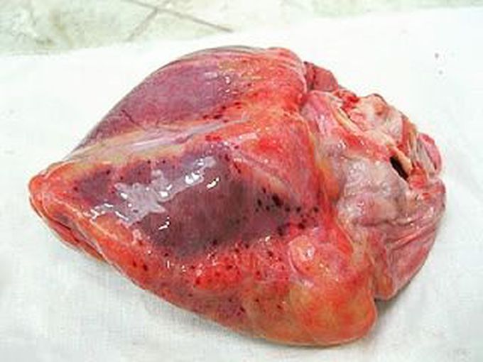 Seeing this heart we can know the person died of asphyxia, but HOW?