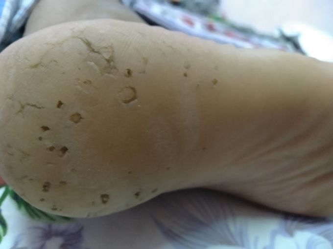 Can someone plzz tell what it is Diagnosis plzzzzz🤔🤔🙄🙄🙄
