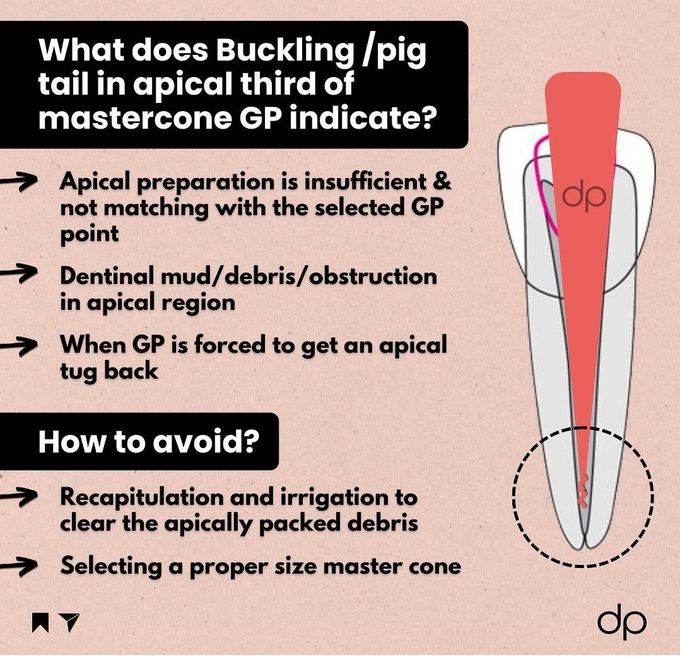 Buckling in Dentistry