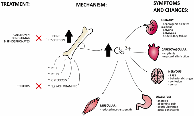 Hypercalcemia