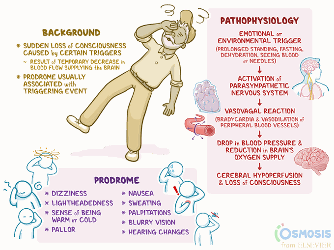 Pathophysiology of vasovagal syncope