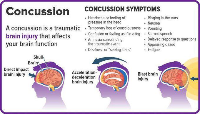 Concussion