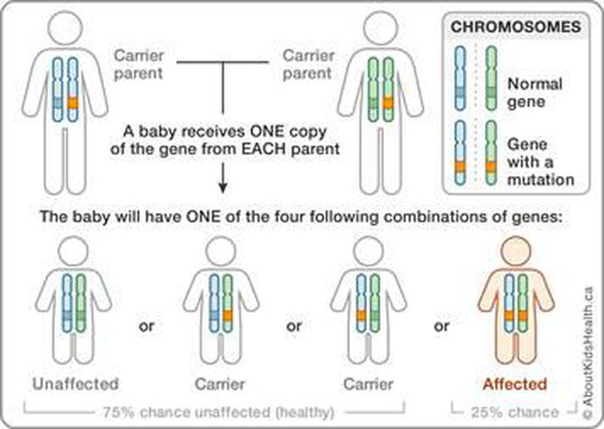 Cause of Hereditary spherocytosis