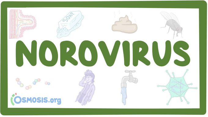 Norovirus - causes, symptoms, diagnosis, treatment, pathology