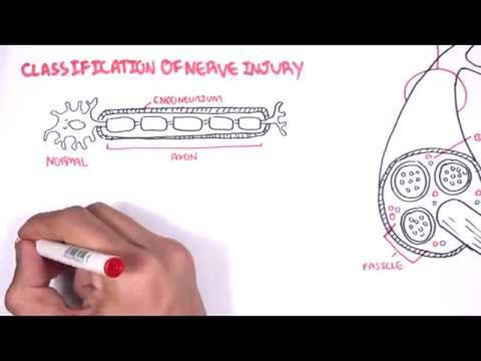 How Do Nerves Get Damaged and Regenerate?