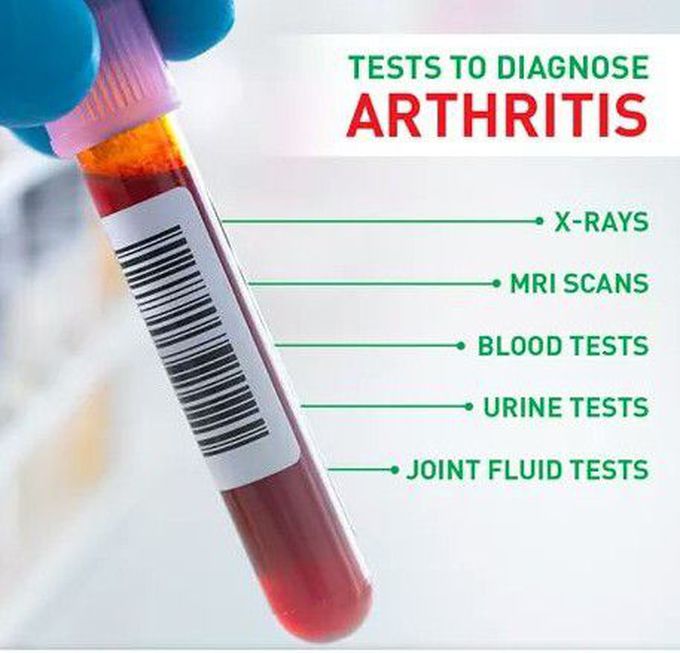 A little symbols for arthritis chek up..