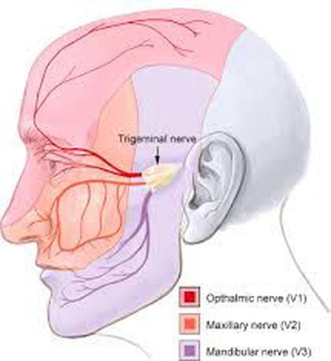 Causes of trigeminal neuralgia