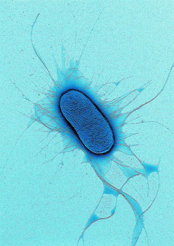E. coli negatively stained with 1% Uranyl acetate.