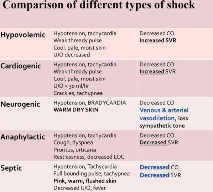 Comparison of different types of shocks