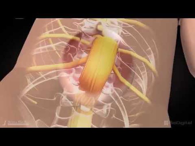 Myelomeningocele -Neural Tube Defect(Animation)
