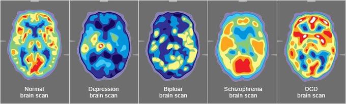 It is interesting to rethink about the behind scenes in psychological cases 