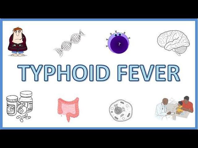 Typhoid