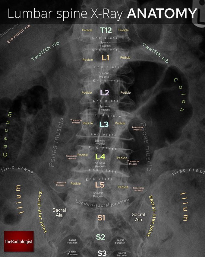 Lumbar spine x-ray anatomy